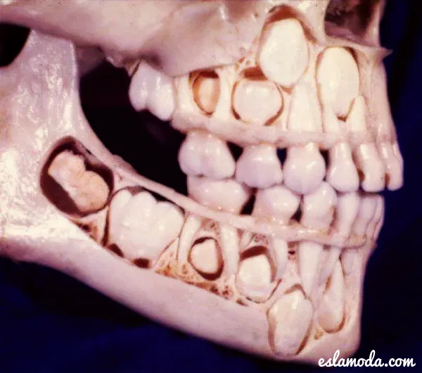 asi-se-ven-los-dientes-antes-de.png