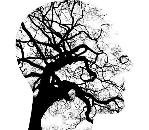 cerebro.jpg