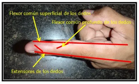 tendones.JPG