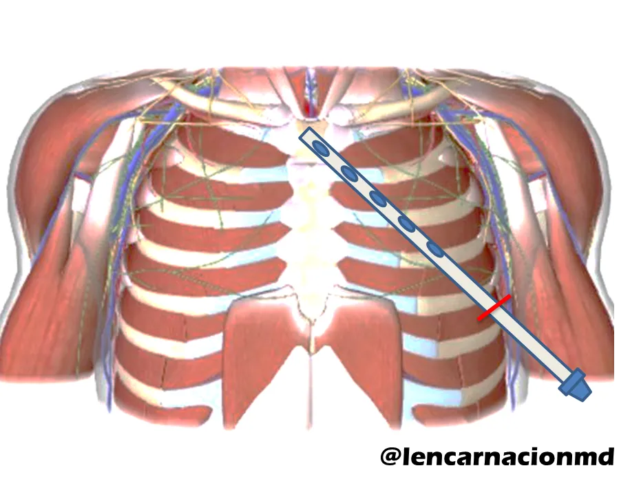 Imagen20.png