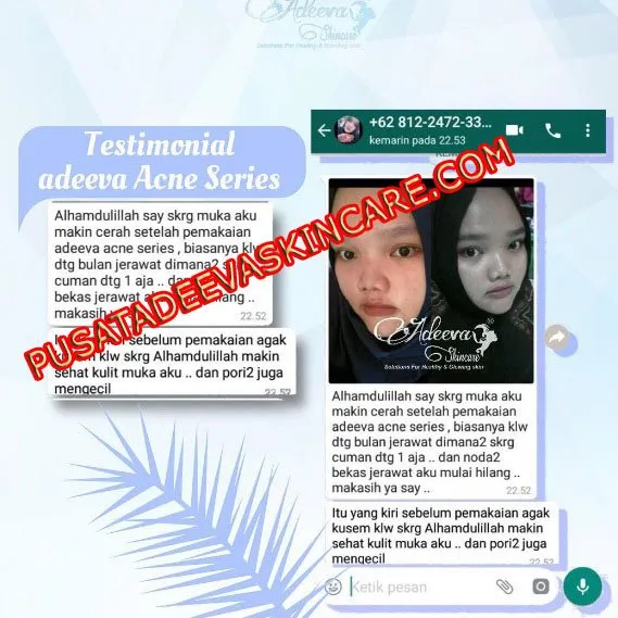 adeeva asli testimoni