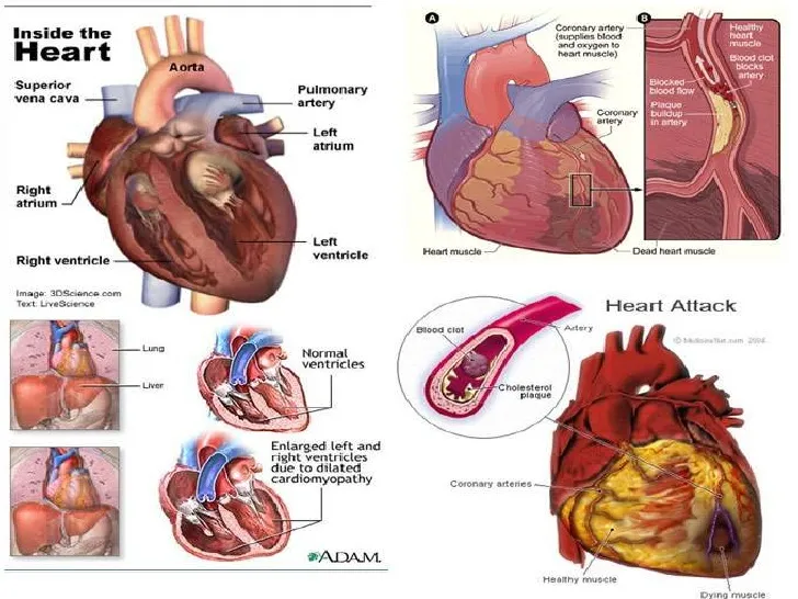 heart-disease-7-728.jpg