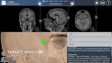 neuro.mp4