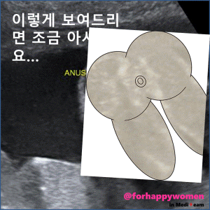 크기변환_슬라이드11.GIF