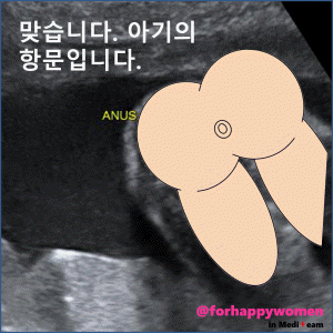 크기변환_슬라이드12.GIF