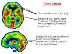 90066e070962a8103c7827849492e98d--panic-attacks-symptoms-stop-panic-attacks.jpg