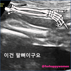 크기변환_슬라이드13.GIF