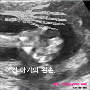 크기변환_슬라이드14.GIF
