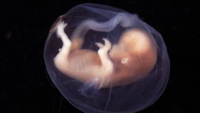 fetus_jpg_653x0_q80_crop-smart.jpg