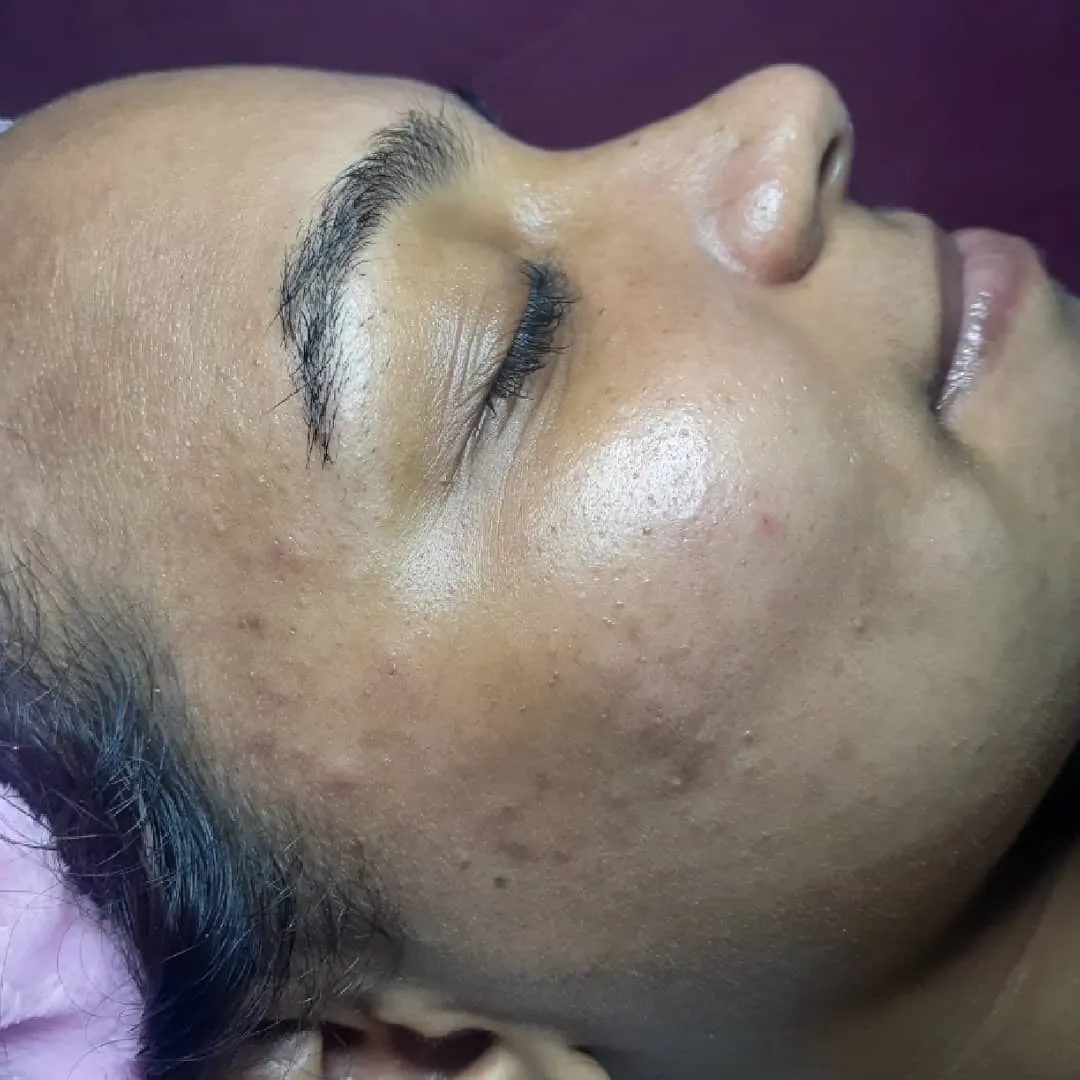 MFBrows_Lashes on Instagram_ _--Limpieza facial  --Epilación de bozo --Epilación de cejas Pigmentación  . . . --Maiquetía_ Calle los  baños. CC.Multicentro_nivel mezanina___CPOM_kwgNYh_0(JPG).jpg