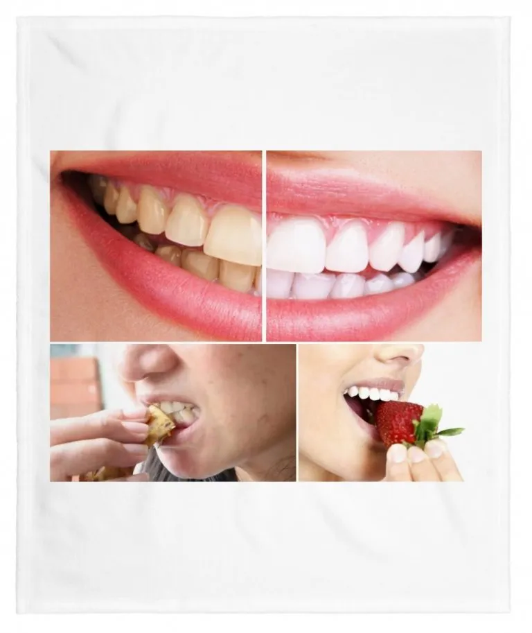 como-blanquear-los-dientes-768x913.jpg