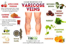 homeopathic remedies varicosis.png