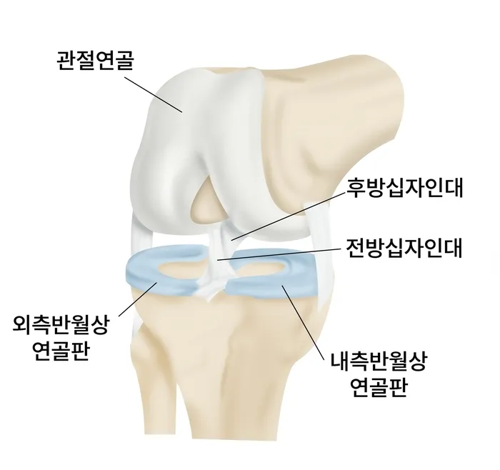 오금이쑤시다 오금이저린다 오금이아프다 종각한의원.jpg