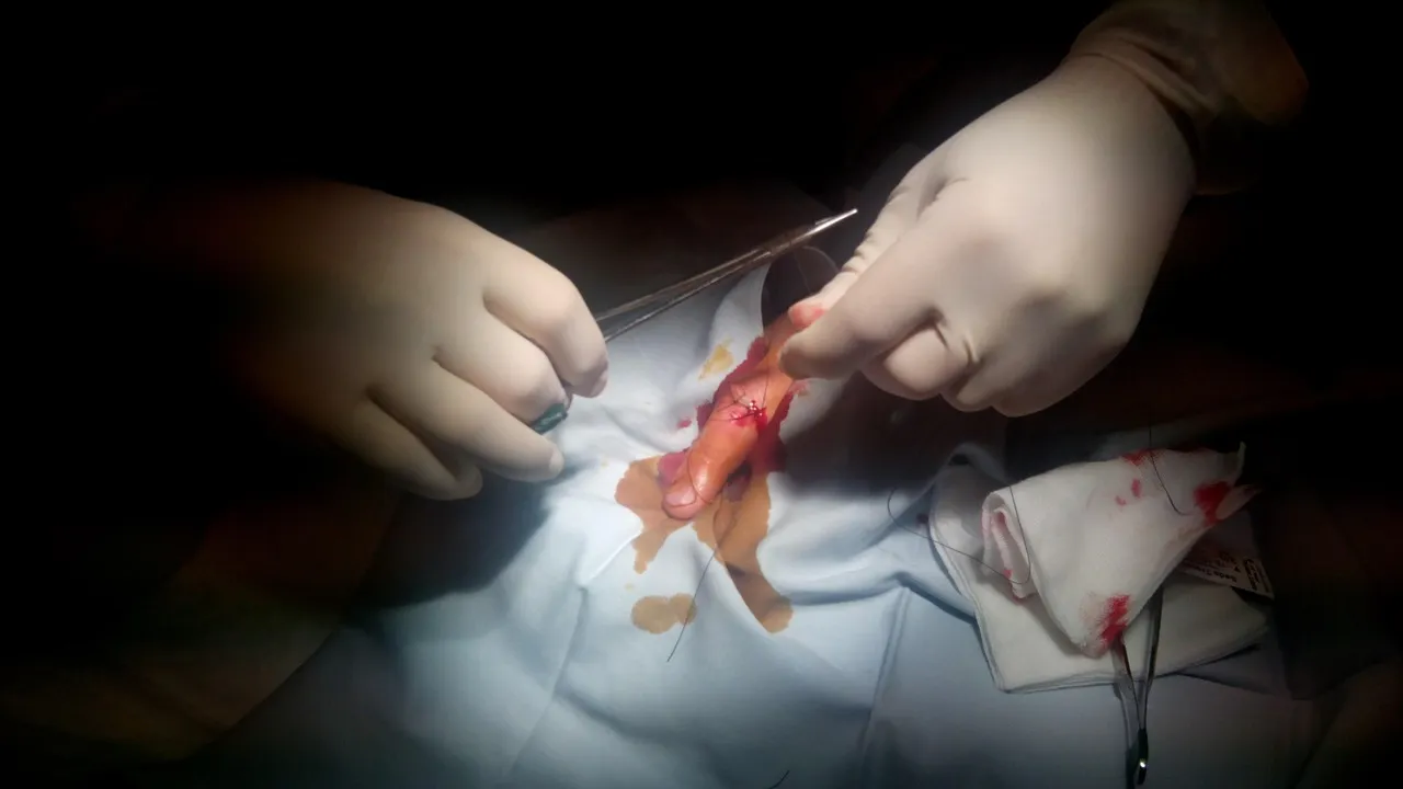 suture-259662_1280.jpg