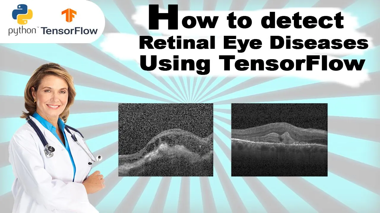Tensorflow retinal eye.jpg