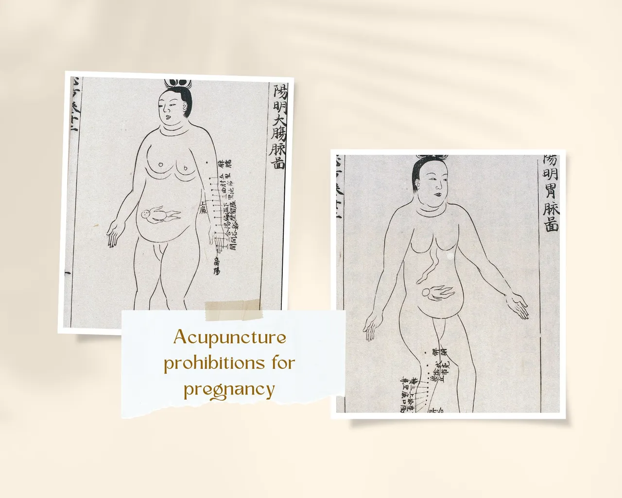 Acupuncture Prohibitions.jpg