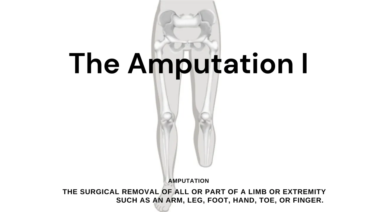 The Amputation I.png
