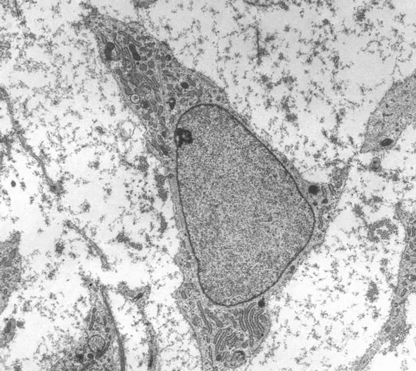 an-innovative-stem-cell-treatment-helps-_re-boot_-blood-and-bone-marrow-for-ms-patients-photo-u1.jpeg