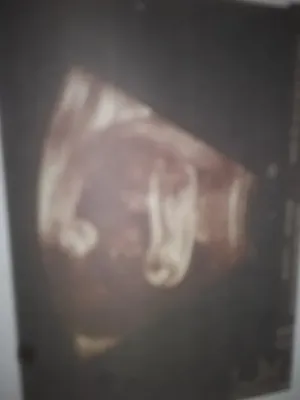 An ultrasound screenshot print confirming it is a boy
