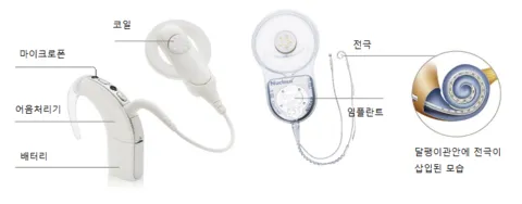 cochlear-pieces.png