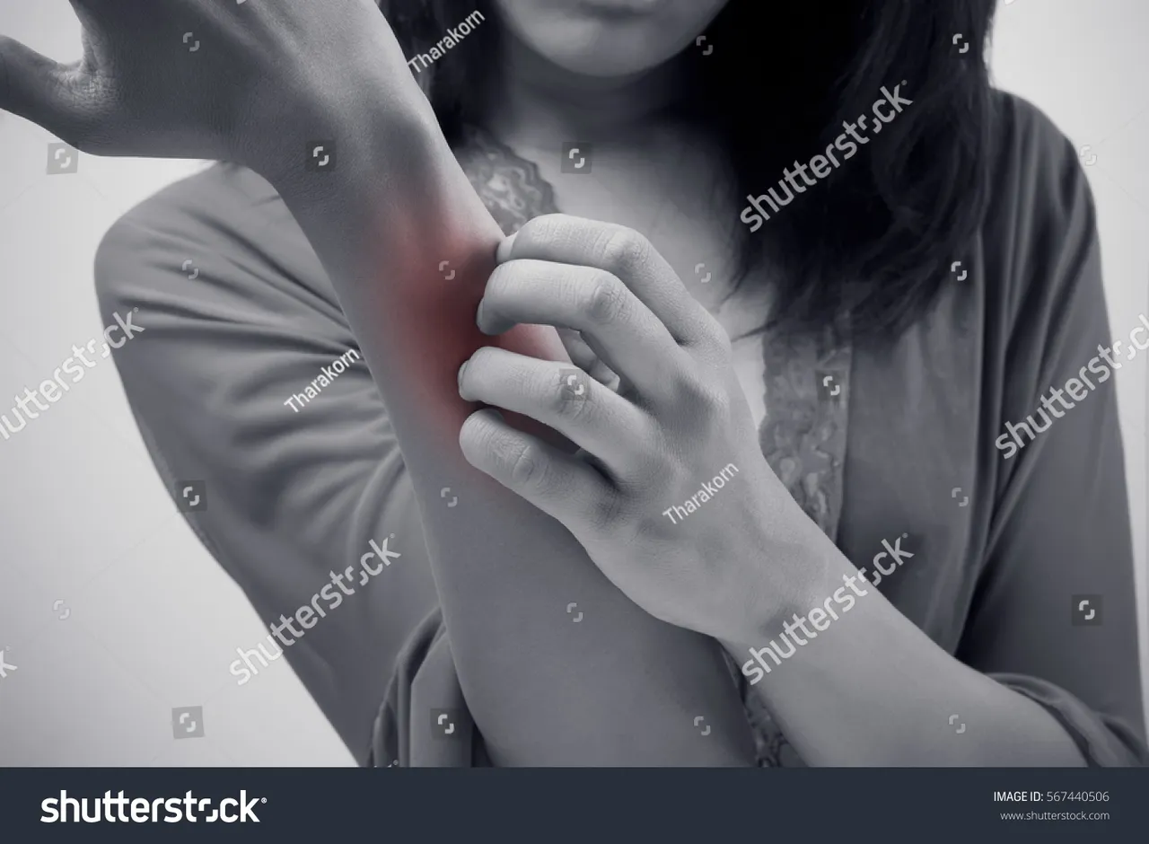 stock-photo-people-scratch-the-itch-with-hand-arm-itching-concept-with-healthcare-and-medicine-567440506.jpg