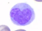 Heart monocyte manatee.jpg