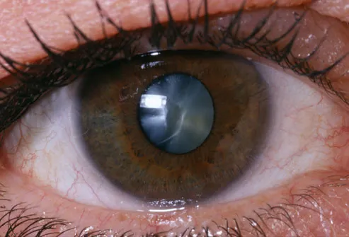 princ_rm_photo_of_close_up_of_eye.jpg