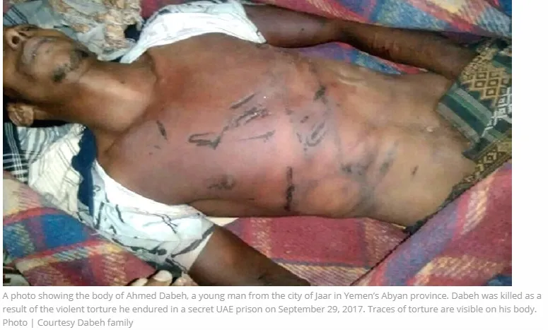 Secret Prison Torture Photo.png