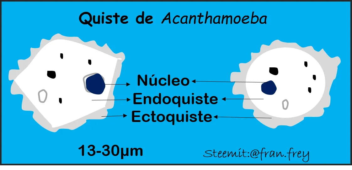 Quiste Acanthamoeba fran.frey.png