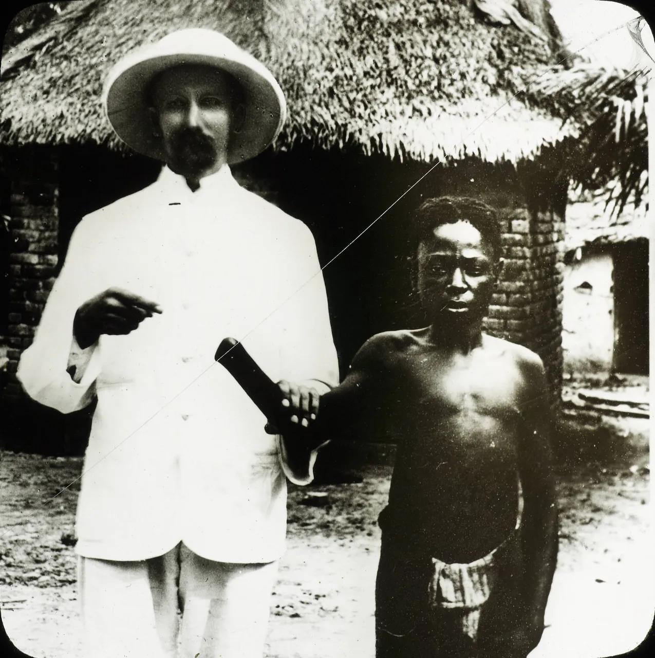 Victim of Congo atrocities, Congo, ca. 1890-1910 (IMP-CSCNWW33-OS10-19).jpg