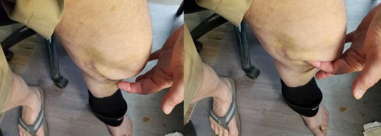 Knee Composite 7-5-21.jpg
