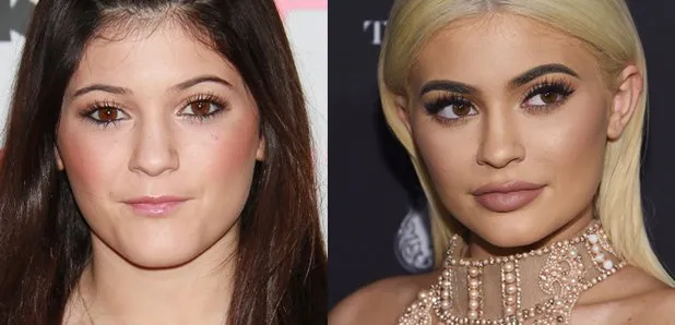 kylie-jenner-transformation-1476874874-article-0.jpg