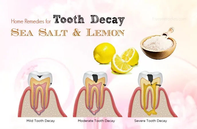 home-remedies-for-tooth-decay-sea-salt-and-lemon.jpg