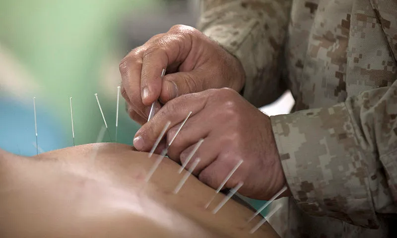 800px-Flickr_-_Official_U.S._Navy_Imagery_-_Cmdr._Yevsey_Goldberg_conducts_an_acupuncture_procedure..jpg