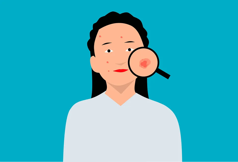 Acne-Face-Girl-Free-vector-graphic-on-Pixabay-rpTN2ZrPEVXp1M.png
