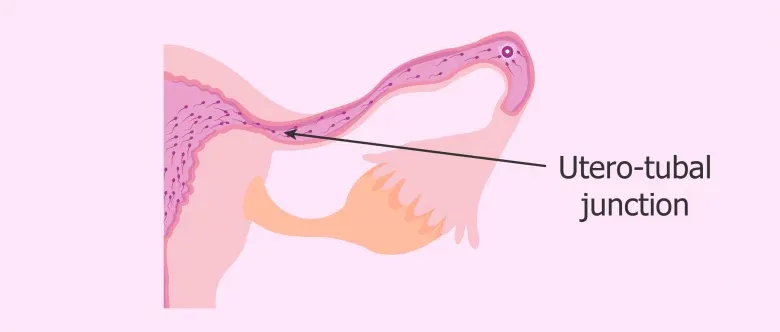 sperm-transport-through-the-uterotubal-junction-780x332.png.webp