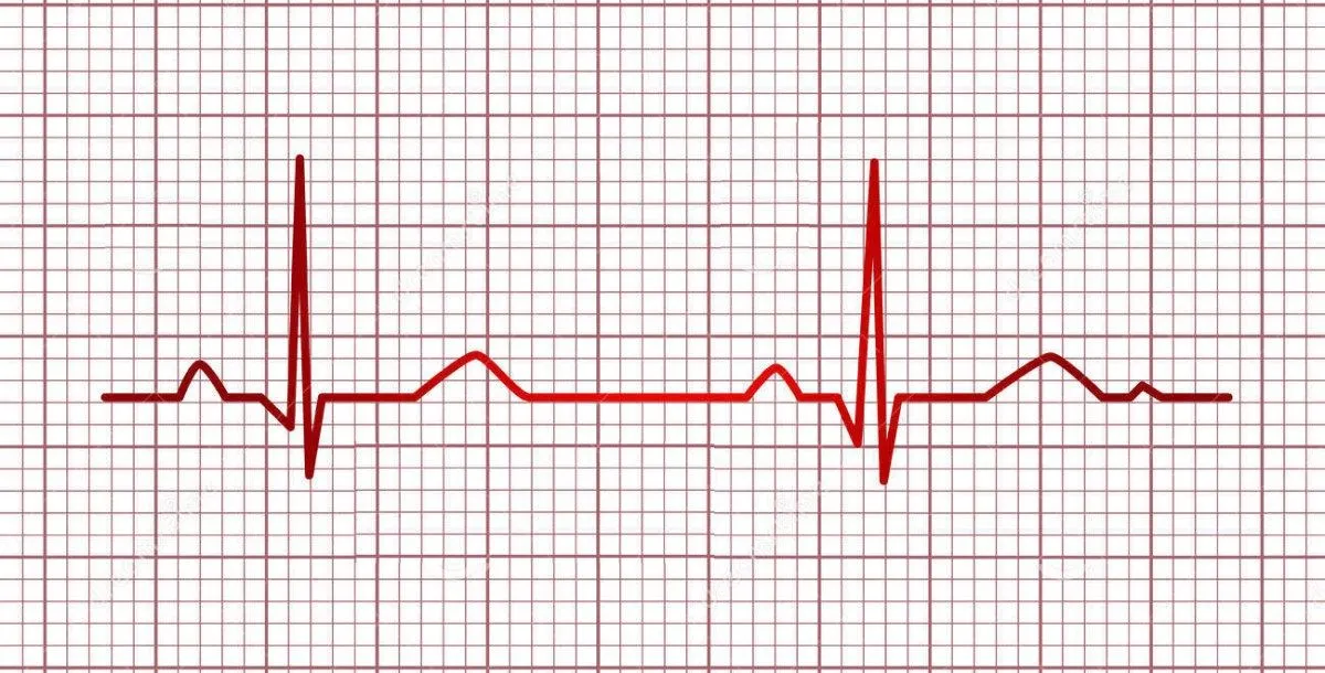 electrocardiograma.jpg