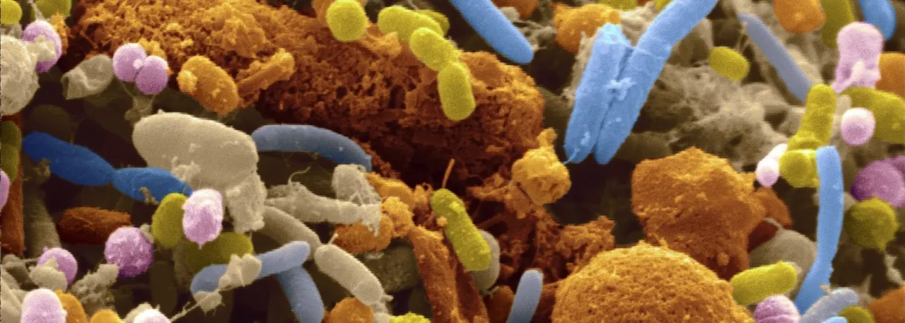 gut-flora-1400x500.jpg