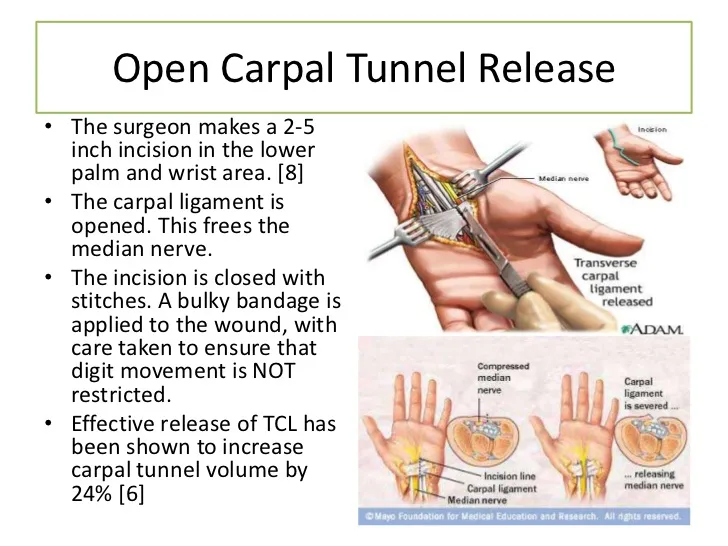 carpal-tunnel-syndrome-21-728.jpg