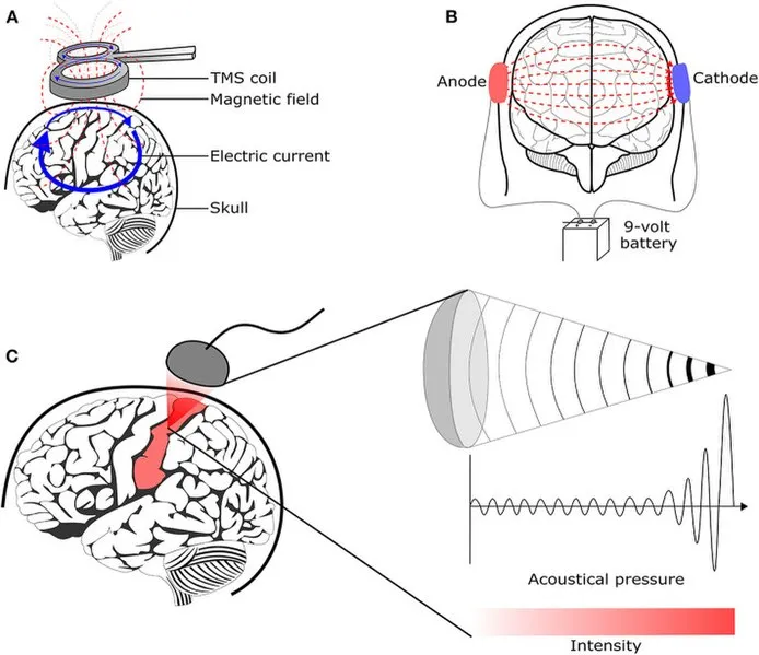 Brain stimulation