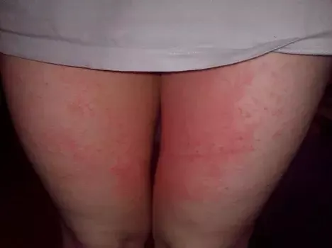 90d155120ab465175d4090c70c5e7c67.png