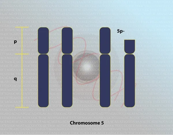 https___ghr.nlm.nih.gov_art_large_chromosome-5p-deletion-in-cri-du-chat-syndrome.jpeg