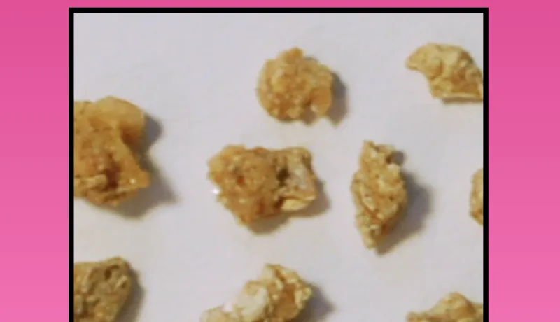 Calcium Oxalate Kidney Stones 800 460.png
