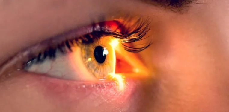 horama-fundraising-retinitis-pigmentosa-764x375.jpg