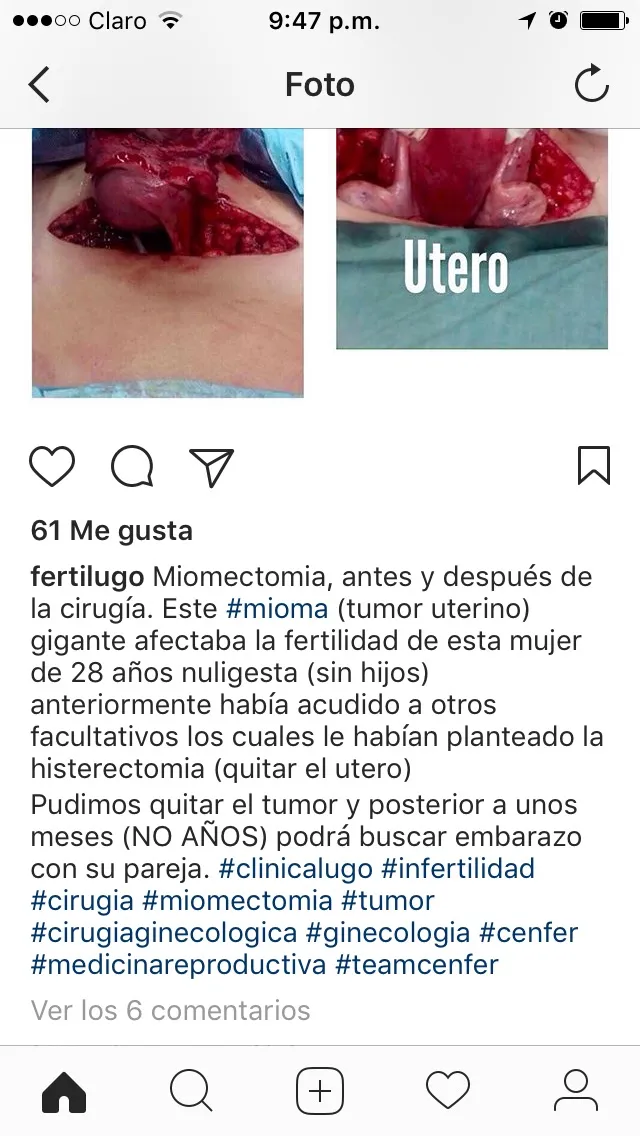 utero.jpg