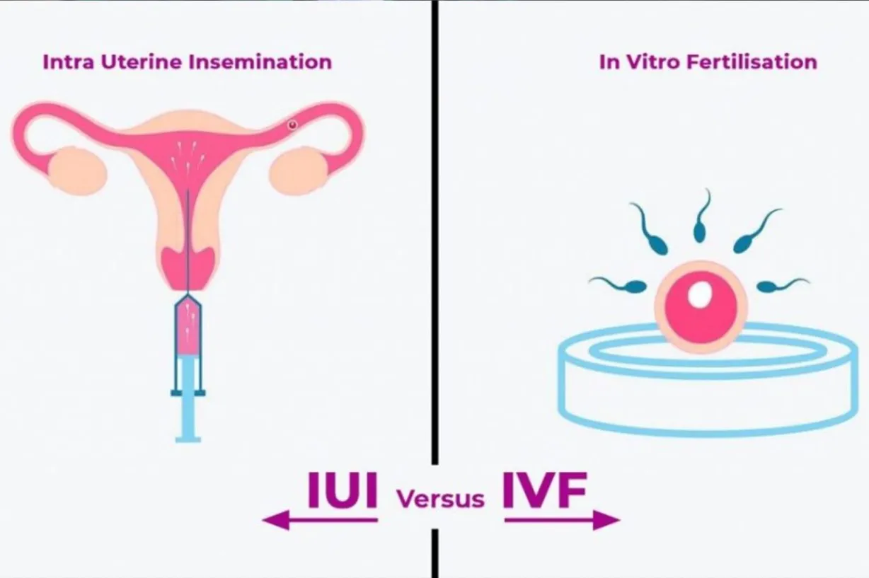 IVF Vs Artificial Insemination.jpg