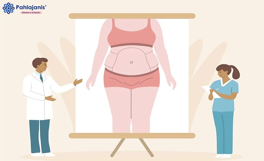 Total Abdominal Hysterectomy 2.jpg