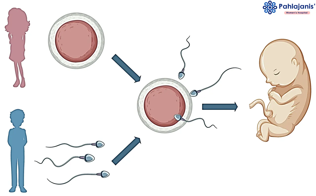 IVF Process - Bilaspur.png