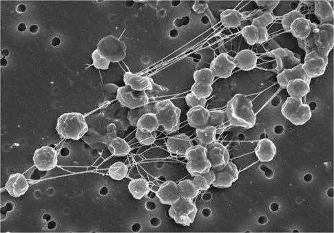 Methanogens Under Microscope