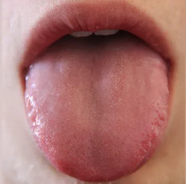 tongue.jpg